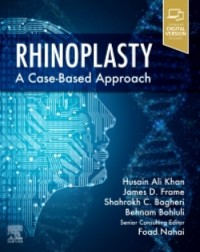 Rhinoplasty: a Case-based approach 1ed (ISBN: 9780323697750) Rhinoplasty: a Case-based approach 1ed (ISBN: 9780323697750)