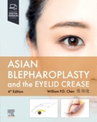 Asian Blepharoplasty and the Eyelid Crease: 4ed e-book (ISBN: 9780323879415)